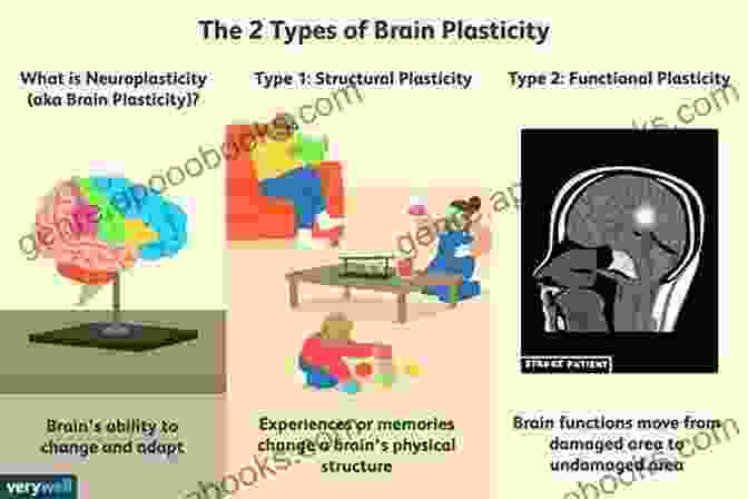 An Illustration Of The Brain's Plasticity Brain Facts (Gray Matter) Michael Sheridan