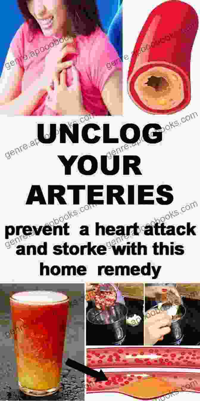 Blocked Arteries NO MORE HEART BLOCKAGE: Research Based Solutions To Remove Blockage In Arteries