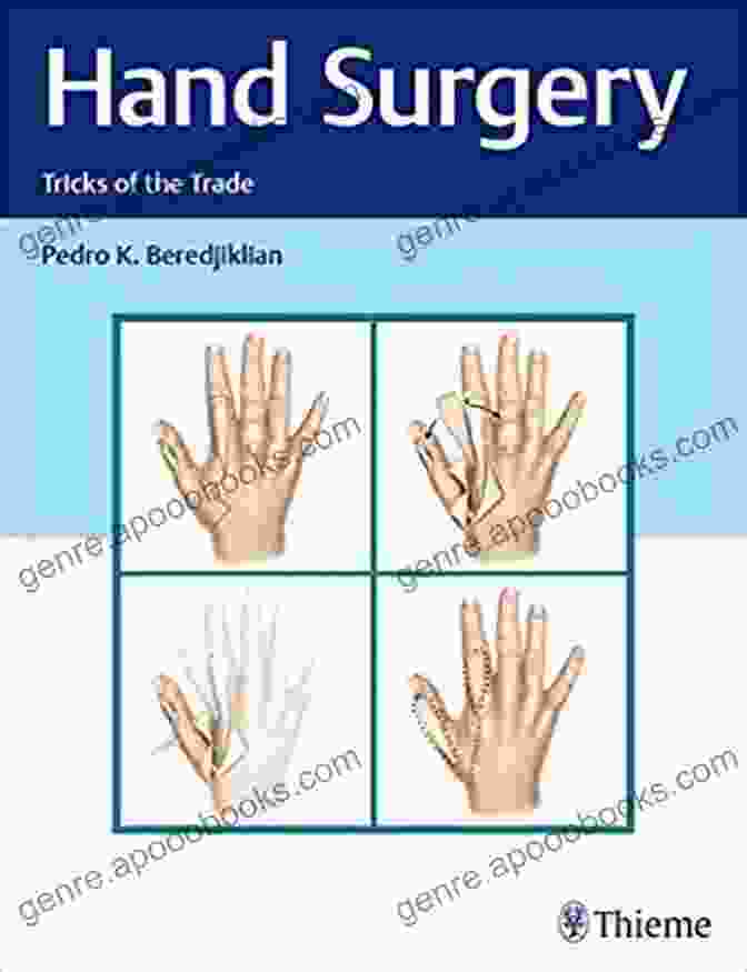 Hand Surgery Tricks Of The Trade Book Cover Featuring A Surgeon's Hand Operating On A Patient's Hand Hand Surgery: Tricks Of The Trade