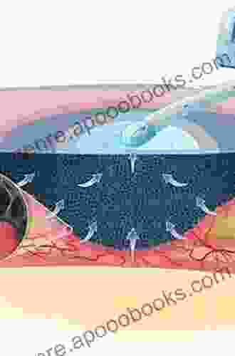 Pressure Injury Diabetes and Negative Pressure Wound Therapy (Recent Clinical Techniques Results and Research in Wounds 3)